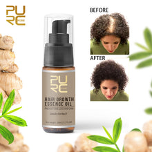 Load image into Gallery viewer, Hair Growth Oil