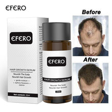 Load image into Gallery viewer, Hair Growth Oil
