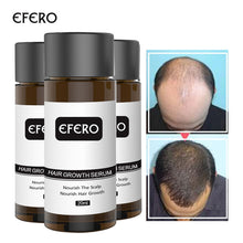 Load image into Gallery viewer, Hair Growth Oil
