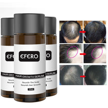Load image into Gallery viewer, Hair Growth Oil
