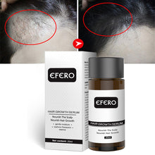 Load image into Gallery viewer, Hair Growth Oil
