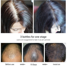 Load image into Gallery viewer, Hair Growth Oil
