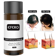 Load image into Gallery viewer, Hair Growth Oil
