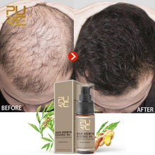 Load image into Gallery viewer, Hair Growth Oil
