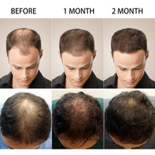 Load image into Gallery viewer, Hair Growth Oil
